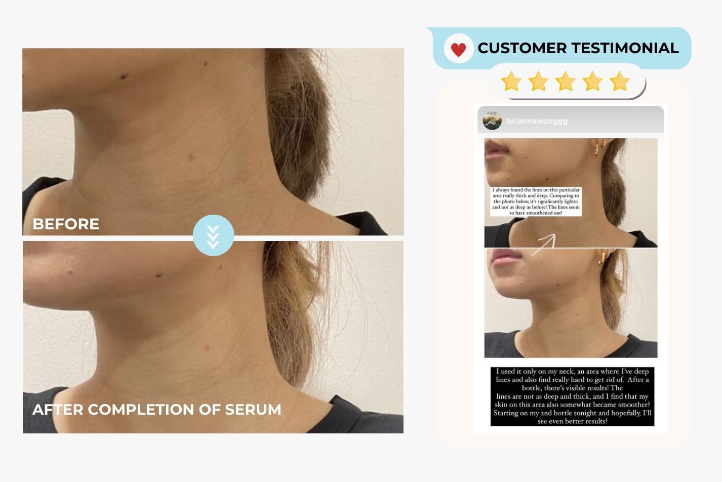 Youth Filler Oligopeptide Complex Serum