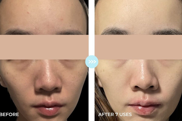 Customer result photo