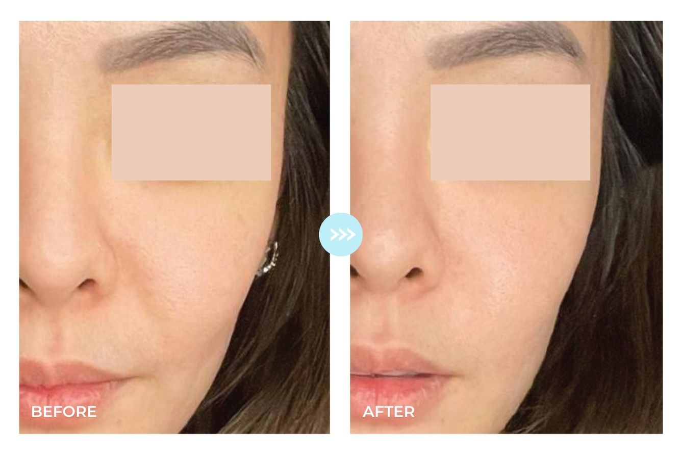 Before and after result 1