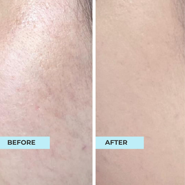 Customer result photo