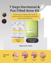 <transcy>祛痘魔王组合</transcy>