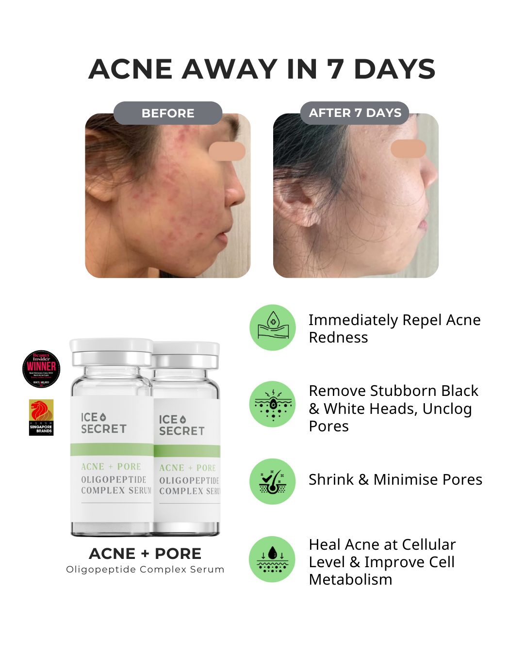 after 7 days acne away, repels redness shrinks pores acne-prone skin Singapore