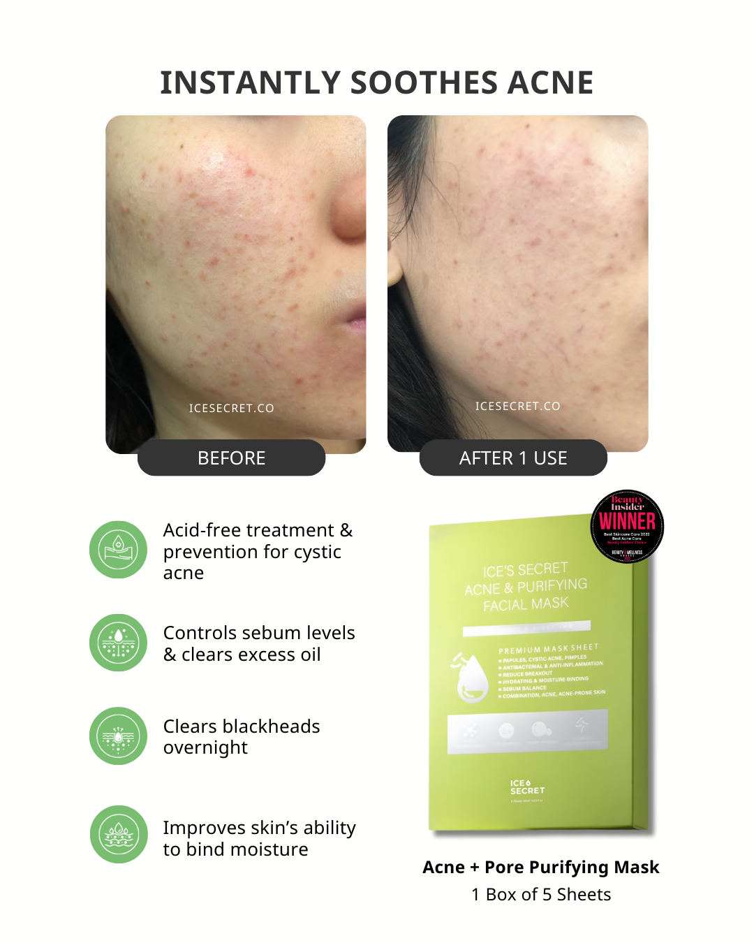 Before and after results using Ice Secret Acne & Pore Purifying Mask on acne-prone skin in Singapore