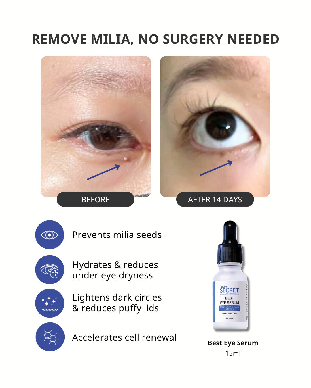 Best Eye Serum Advanced