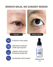 Best Eye Serum Advanced