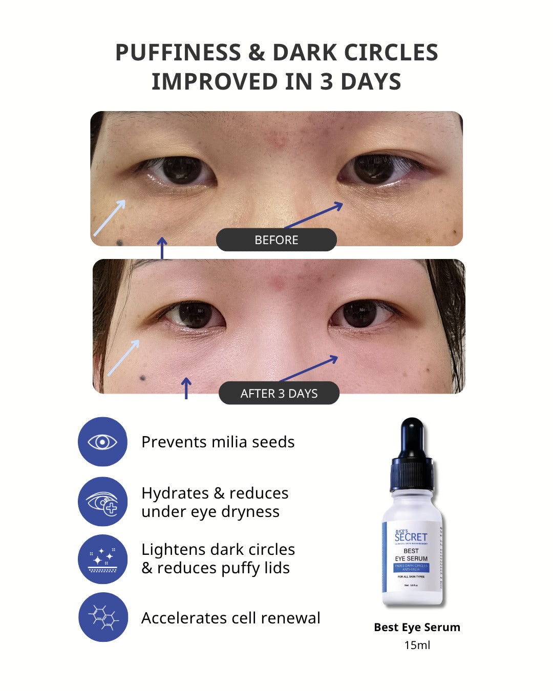 Best Eye Serum Advanced