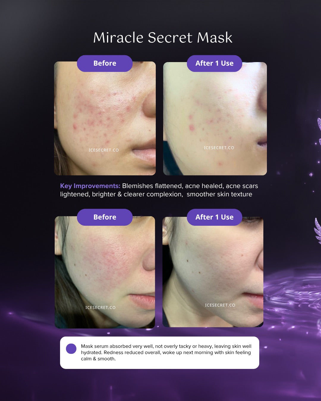 [Flash Deal] Miracle Secret Mask Bundle