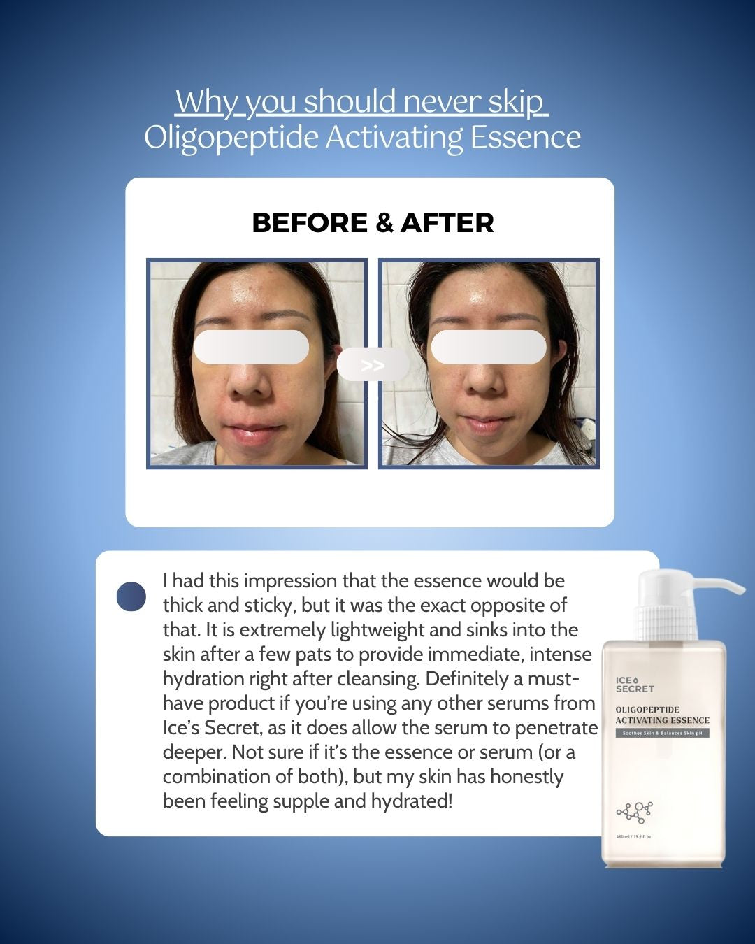 Ice Secret oligopeptide activating essence before and after Singapore