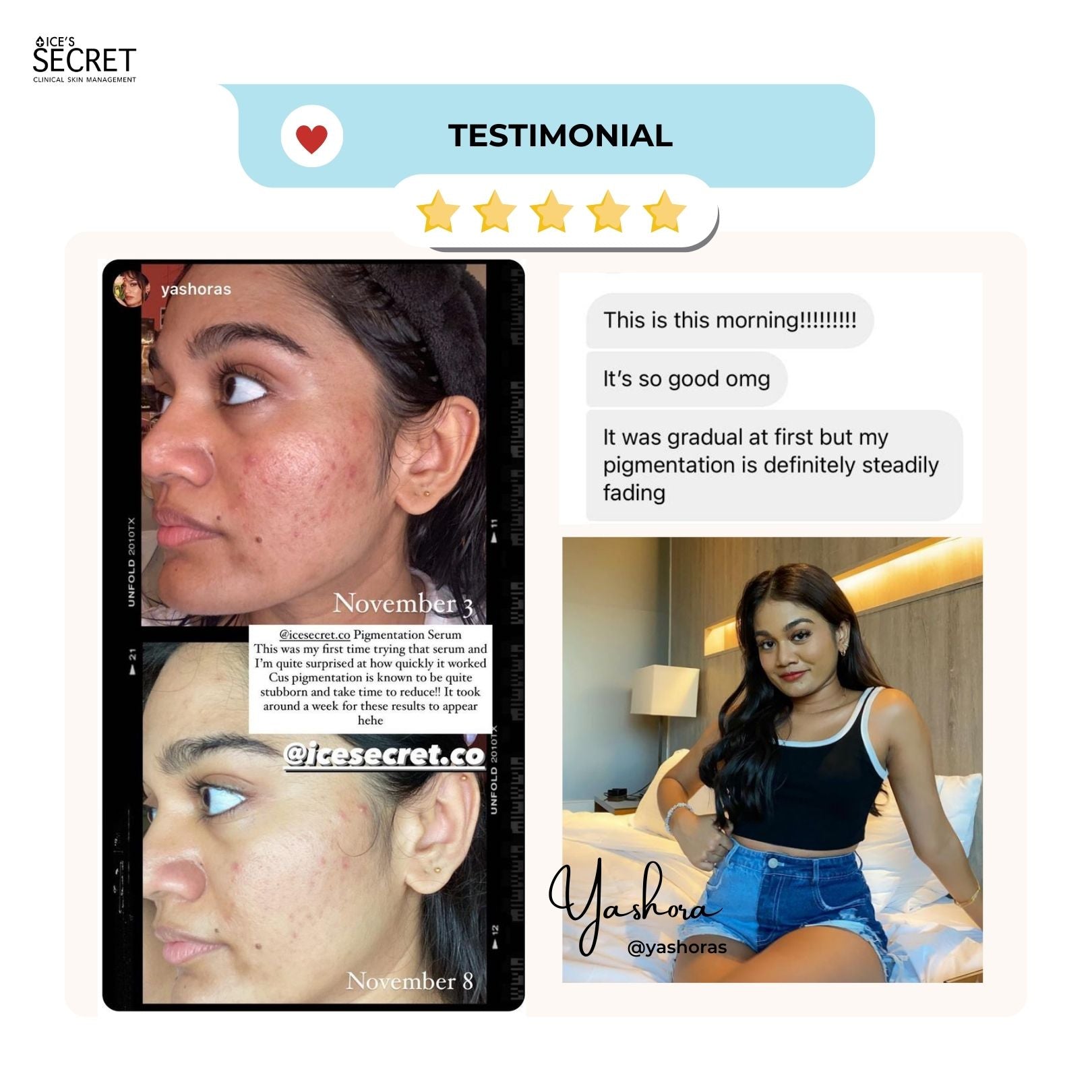 Ice Secret pigmentation serum customer's review for pigmented and uneven skin tone Singapore
