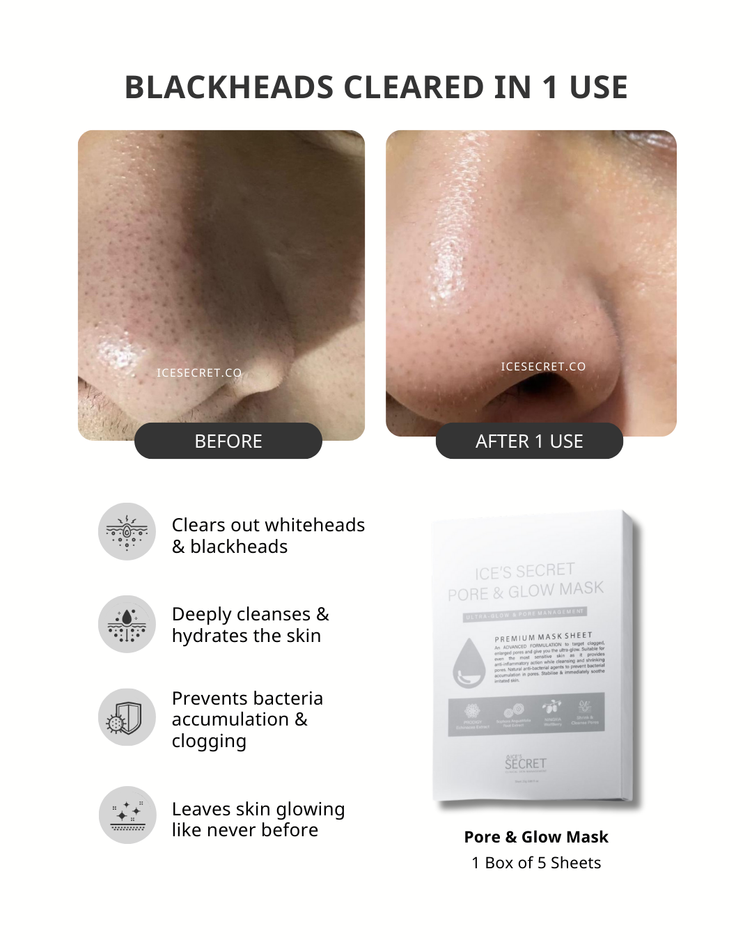 Before and after results using Ice Secret Pore & Glow Mask showing clearer, less visible pores and smoother skin