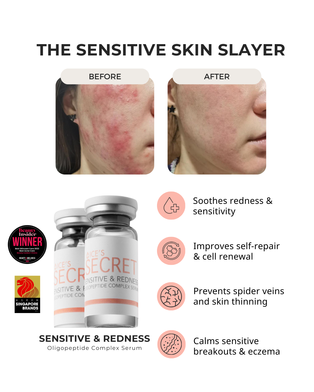 Ice Secret sensitive and redness oligpopeptide complex serum before and after, Singapore