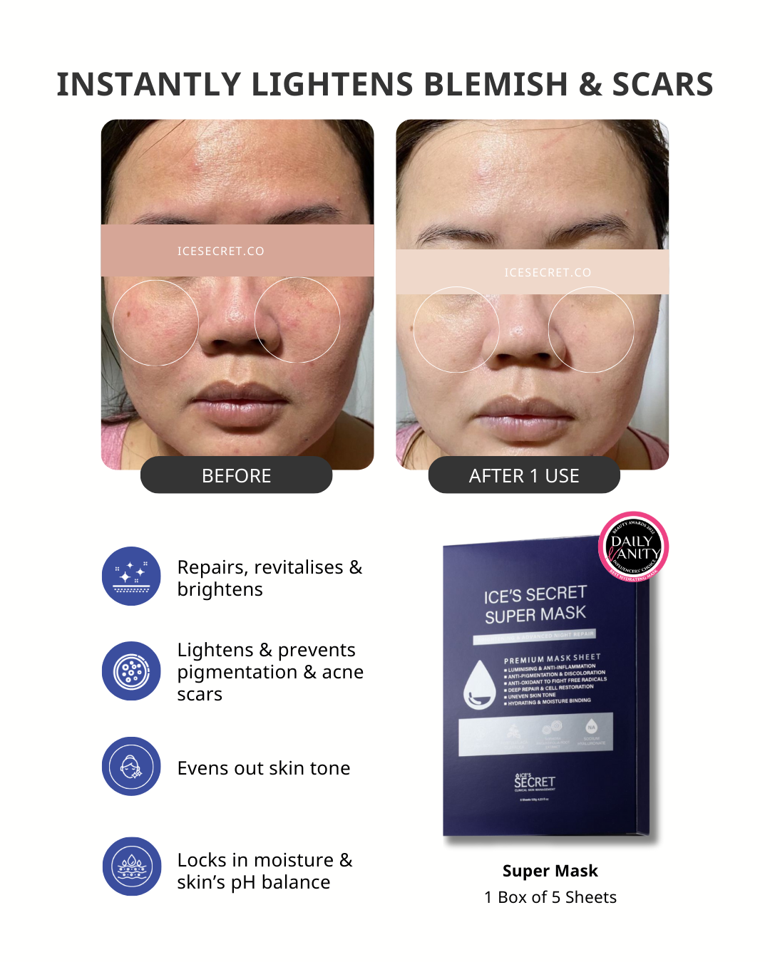 Before and after results using Ice Secret Super Mask showing lighter blemishes and scars and more even skin tone