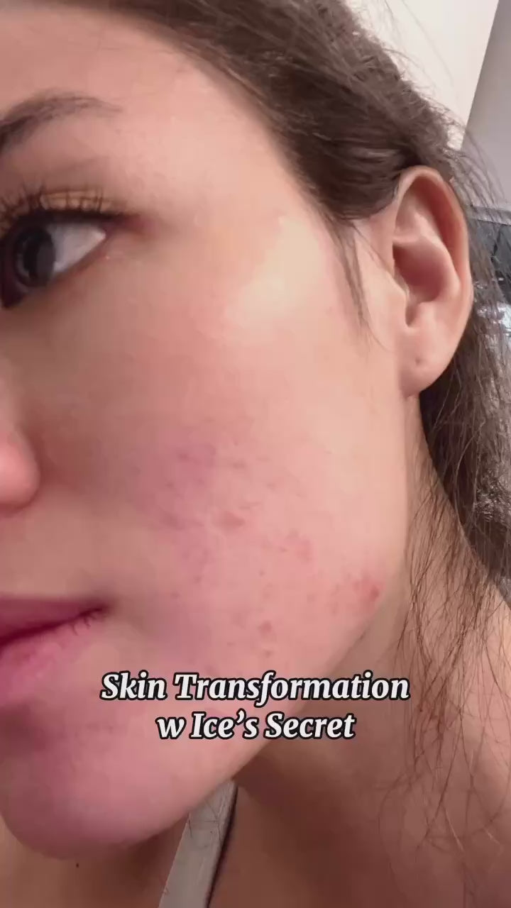 Scar & Blemish 7 Day Kit