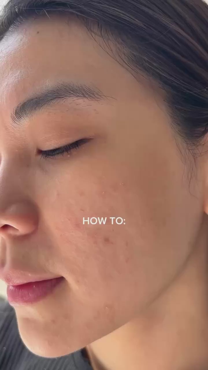 Sensitive & Redness 7 Days Kit