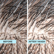 03 Purifying & Scalp Detox Shampoo