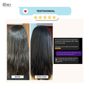 Itchy Scalp Kit