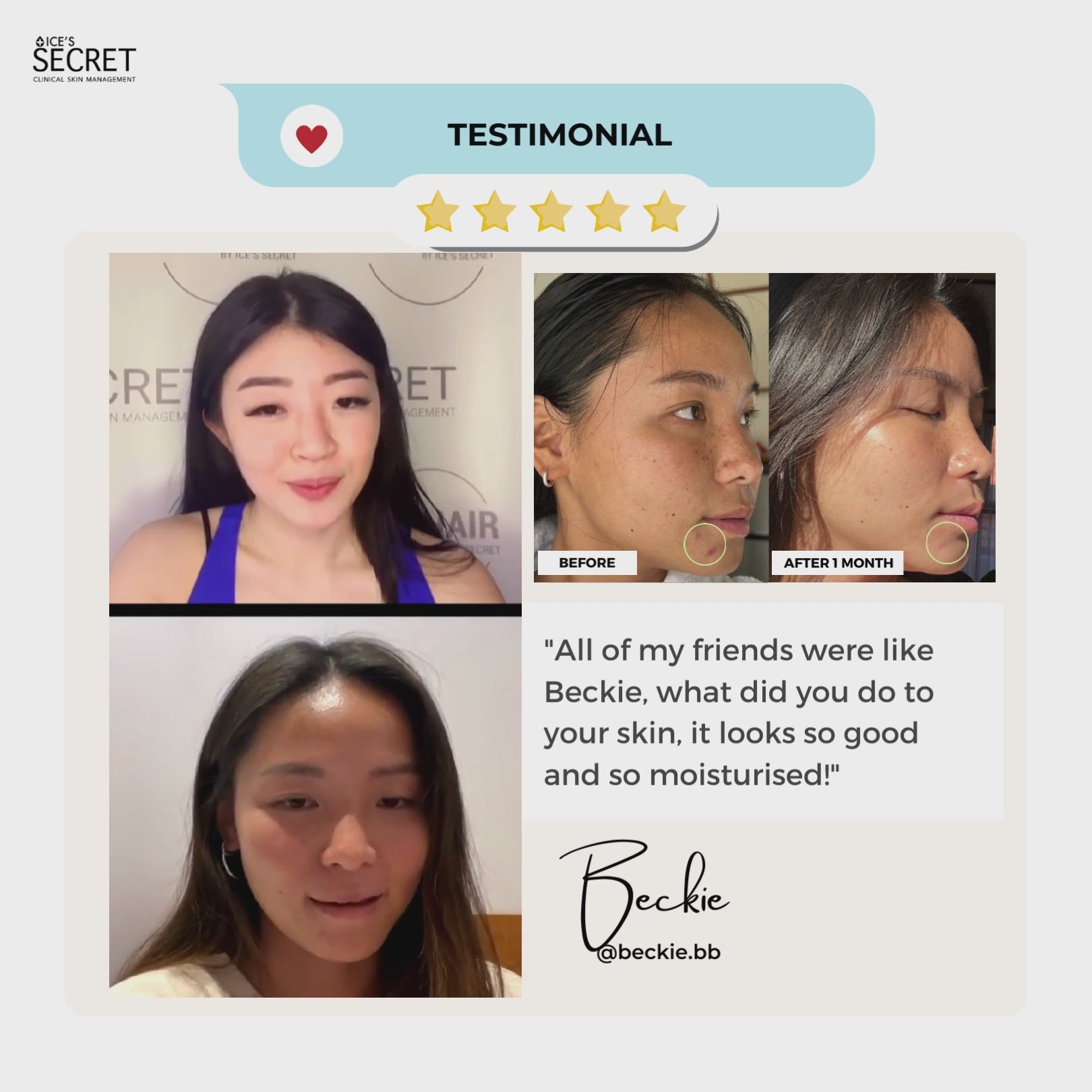 Acne Advance Kit