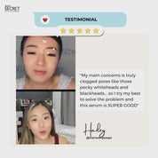 BEST SELLER: Smooth Skin, Brightening Kit