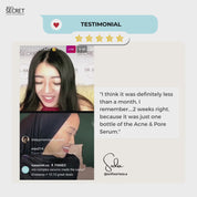 Acne Advance Kit