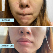 Miracle Secret Mask