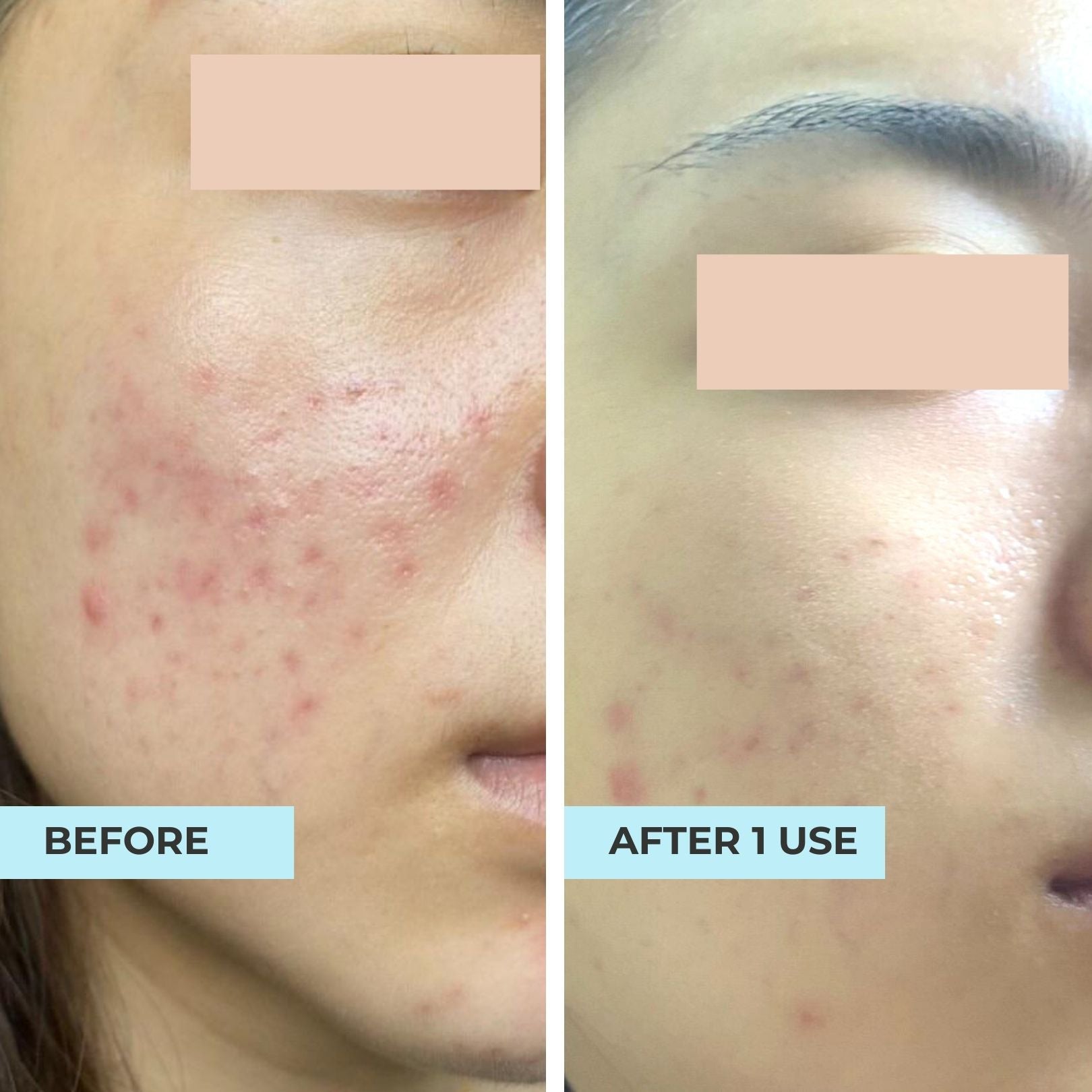 Miracle Secret Mask - Oligopeptide Skincare – Ice's Secret