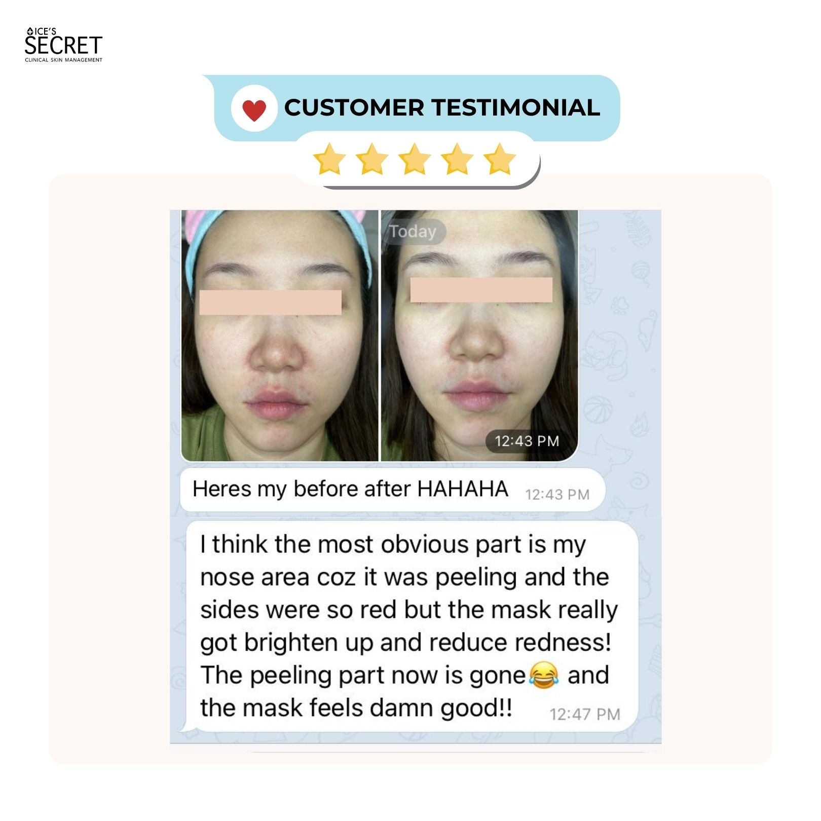 Miracle Secret Mask - Oligopeptide Skincare – Ice's Secret