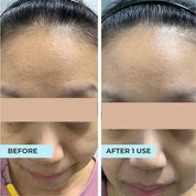 XL Youth Filler Face & Neck Mask