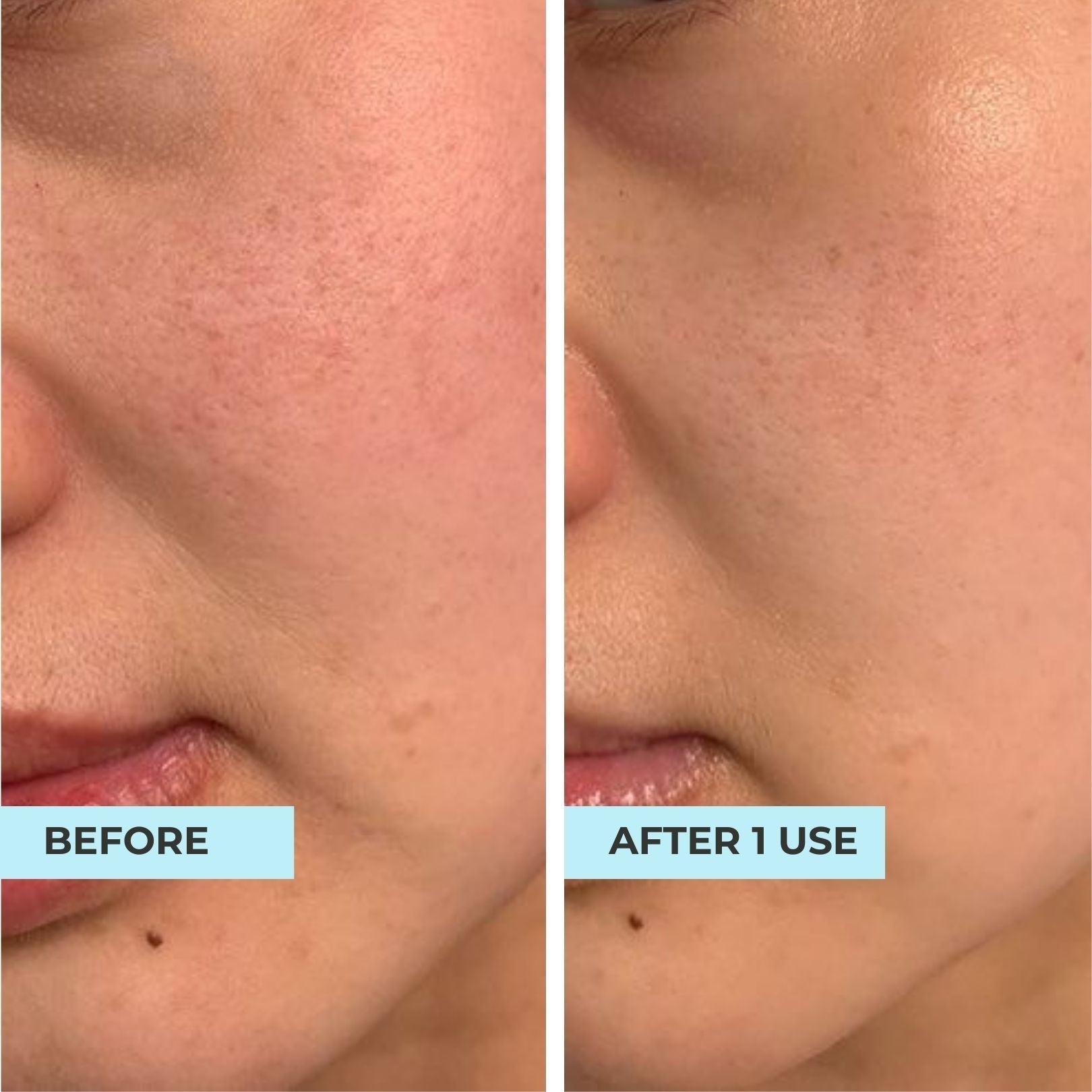 [IWD]Youth Filler Mask Bundle A