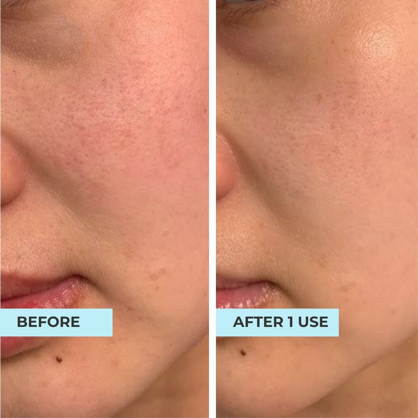 XL Youth Filler Face & Neck Mask