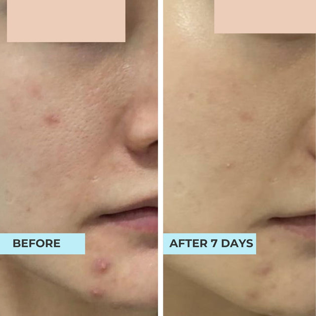 Customer result photo
