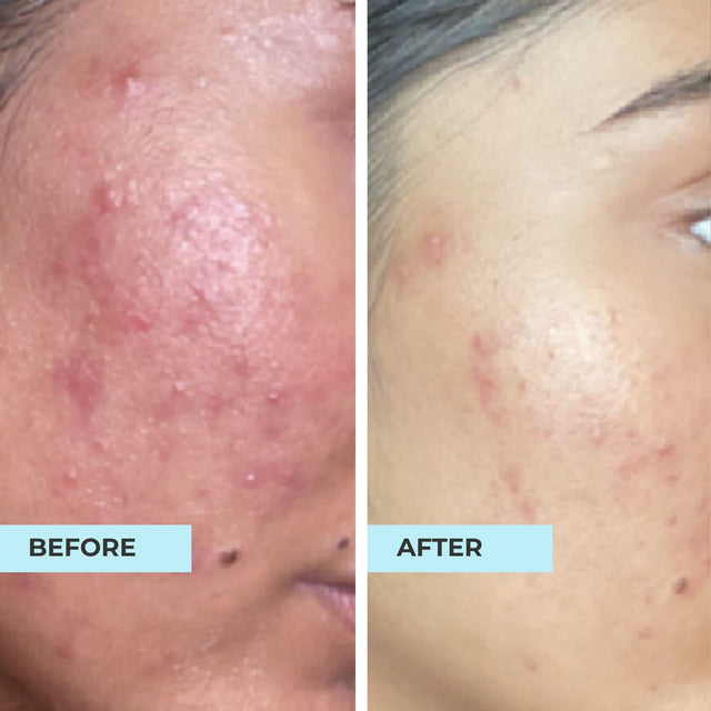 Customer result photo