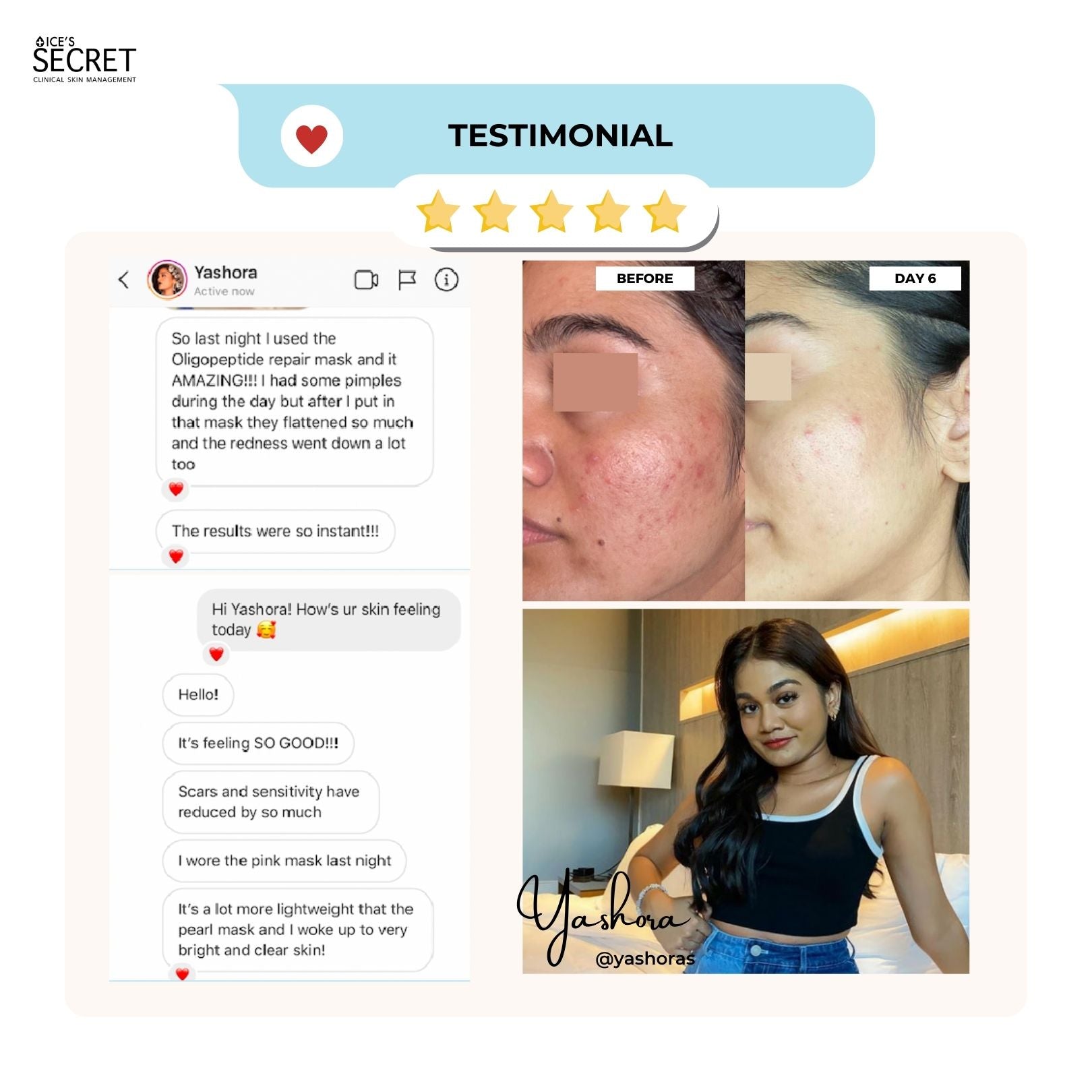 Acne + Pore II (For Cystic Acne) Advanced Oligopeptide Complex Serum