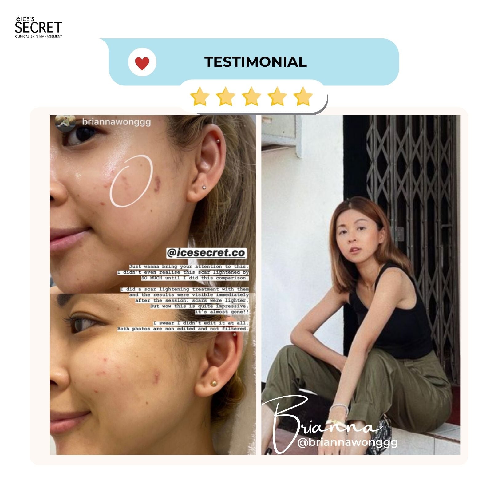 Acne + Pore II (For Cystic Acne) Advanced Oligopeptide Complex Serum