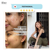 Acne + Pore II (For Cystic Acne) Advanced Oligopeptide Complex Serum