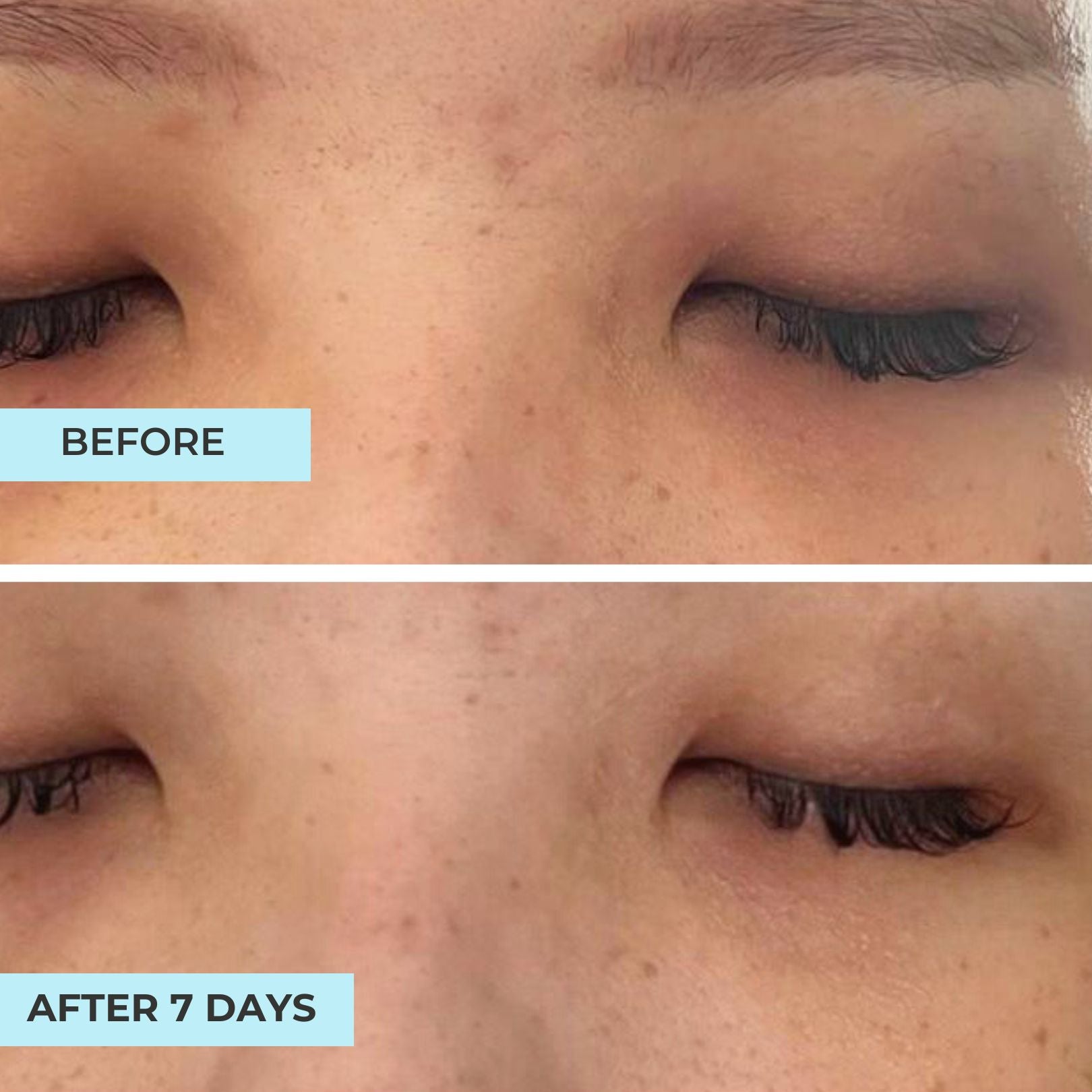 Brighten & Repair Advanced Eye Concentrate
