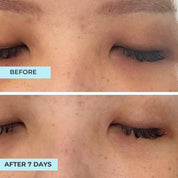 Brighten & Repair Advanced Eye Concentrate