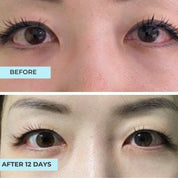 Brighten & Repair Advanced Eye Concentrate