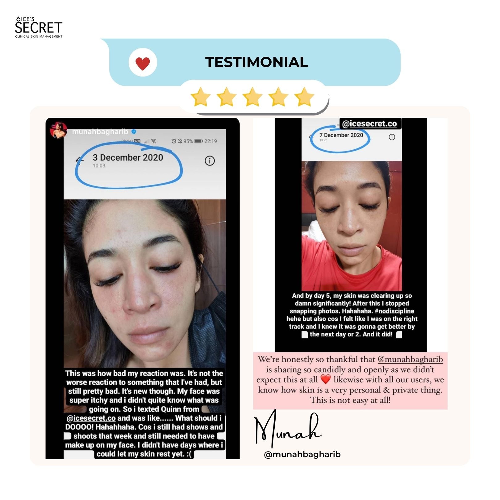 Lift & Bouncy Skin Kit