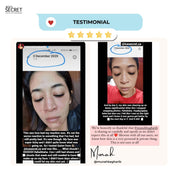 Lift & Bouncy Skin Kit