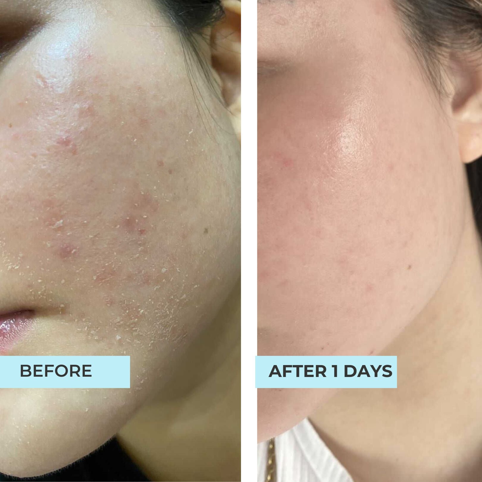 Miracle Secret Lift & Repair Oligopeptide Moisturiser
