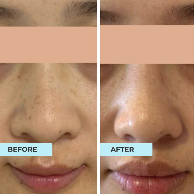 Customer result photo