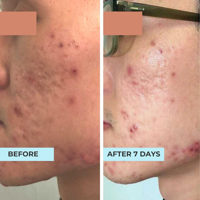 Customer result photo