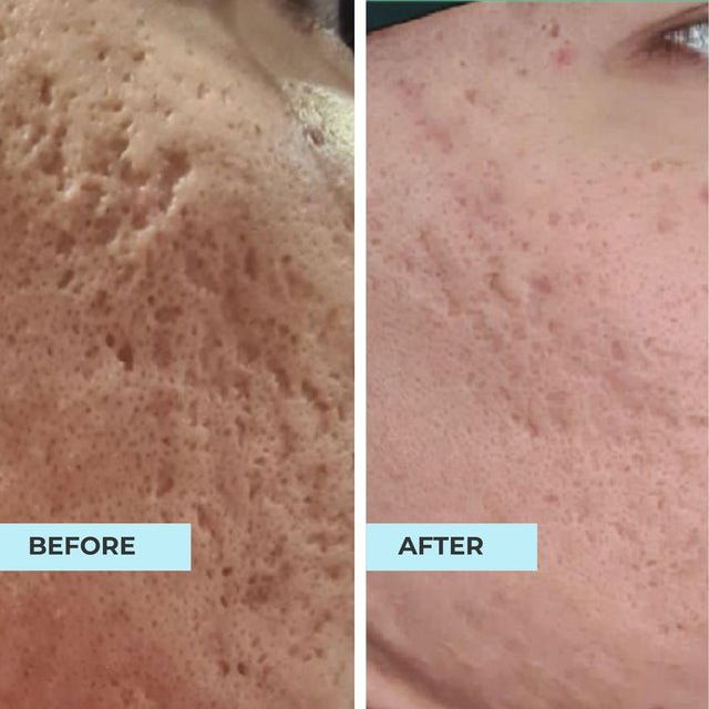 Customer result photo