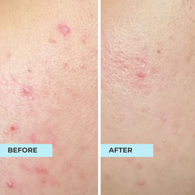 Customer result photo