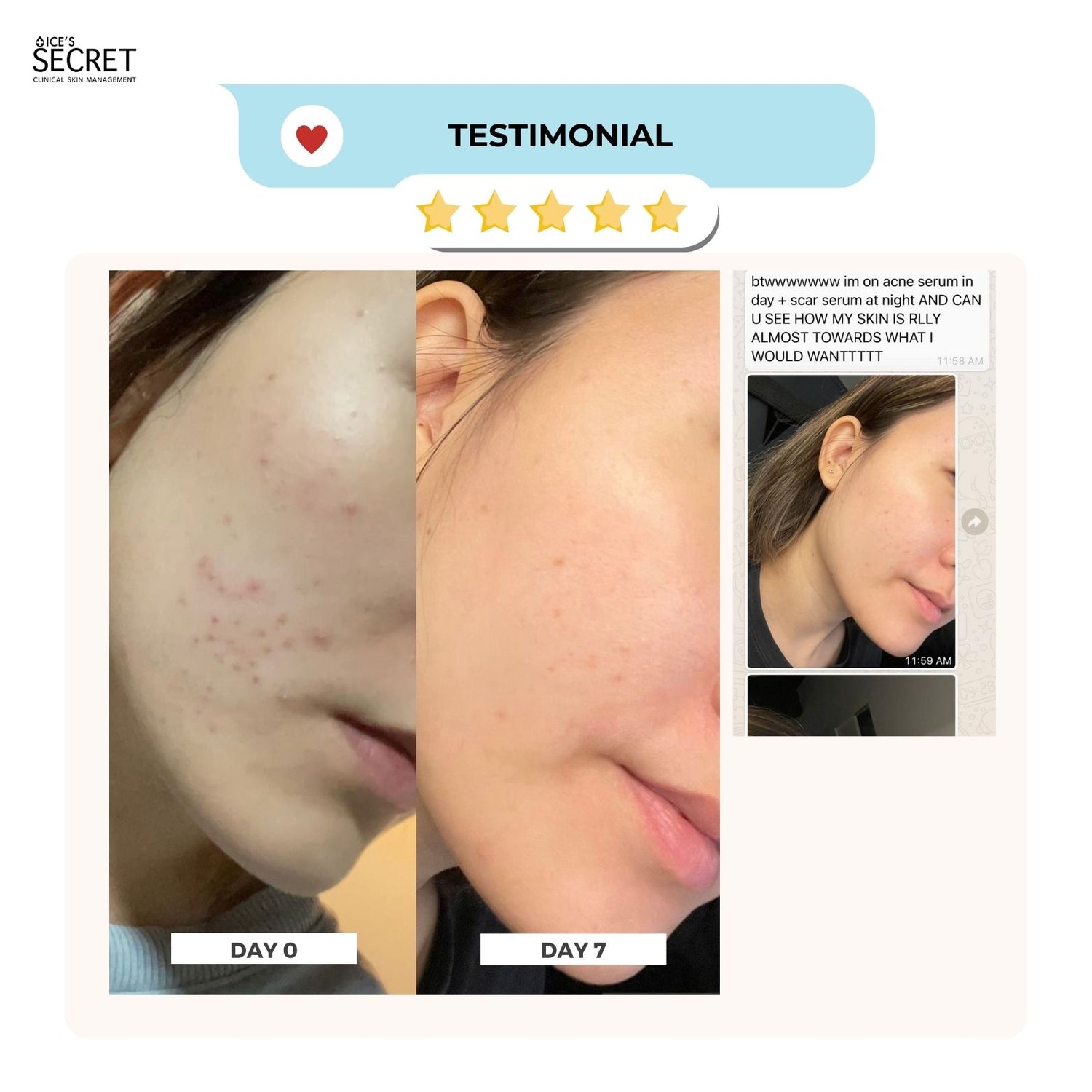 RESCUE ONE (SOS) 🧉For sport & blemish scars 🧉Improves the