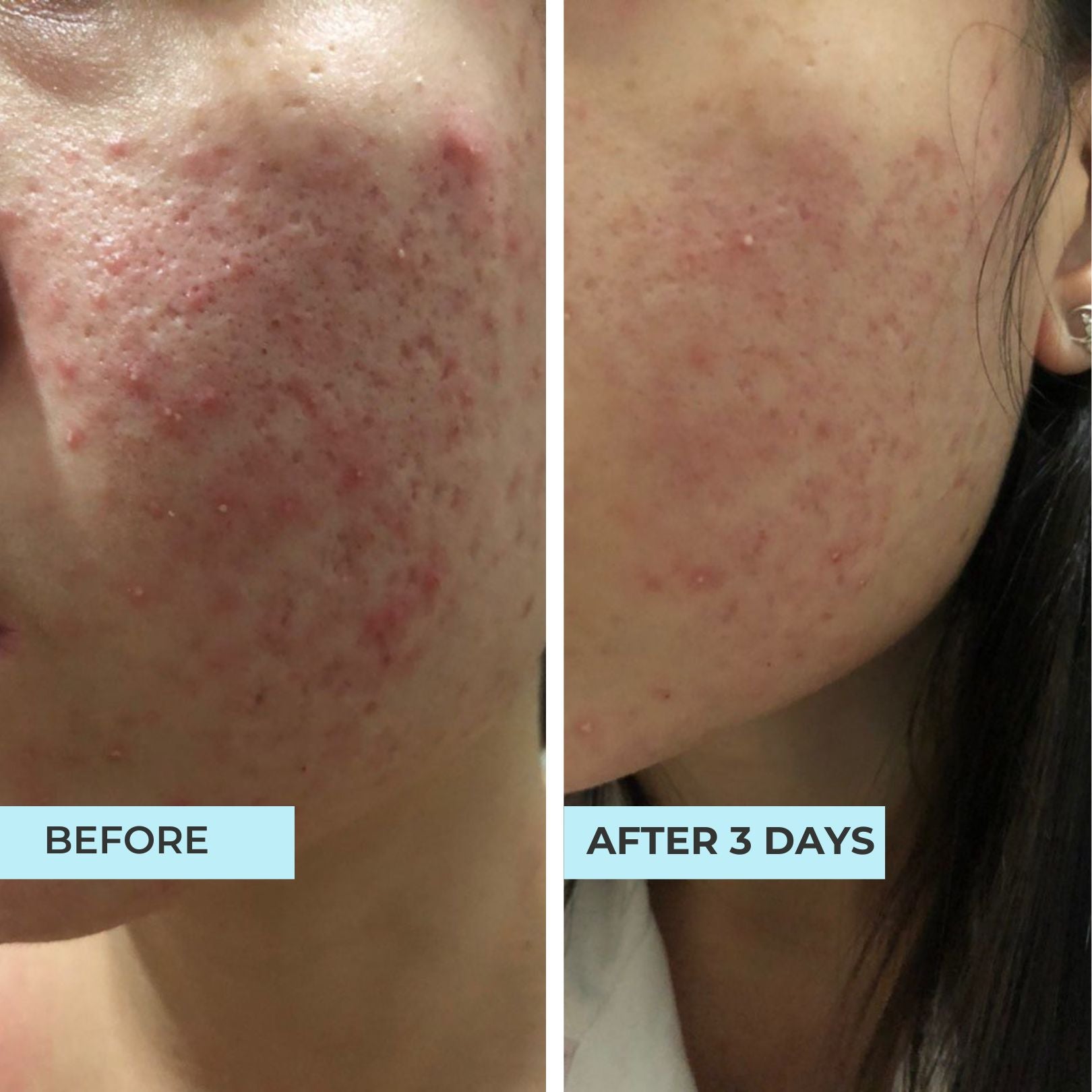 Secret Repair Hydrating Oligopeptide Serum