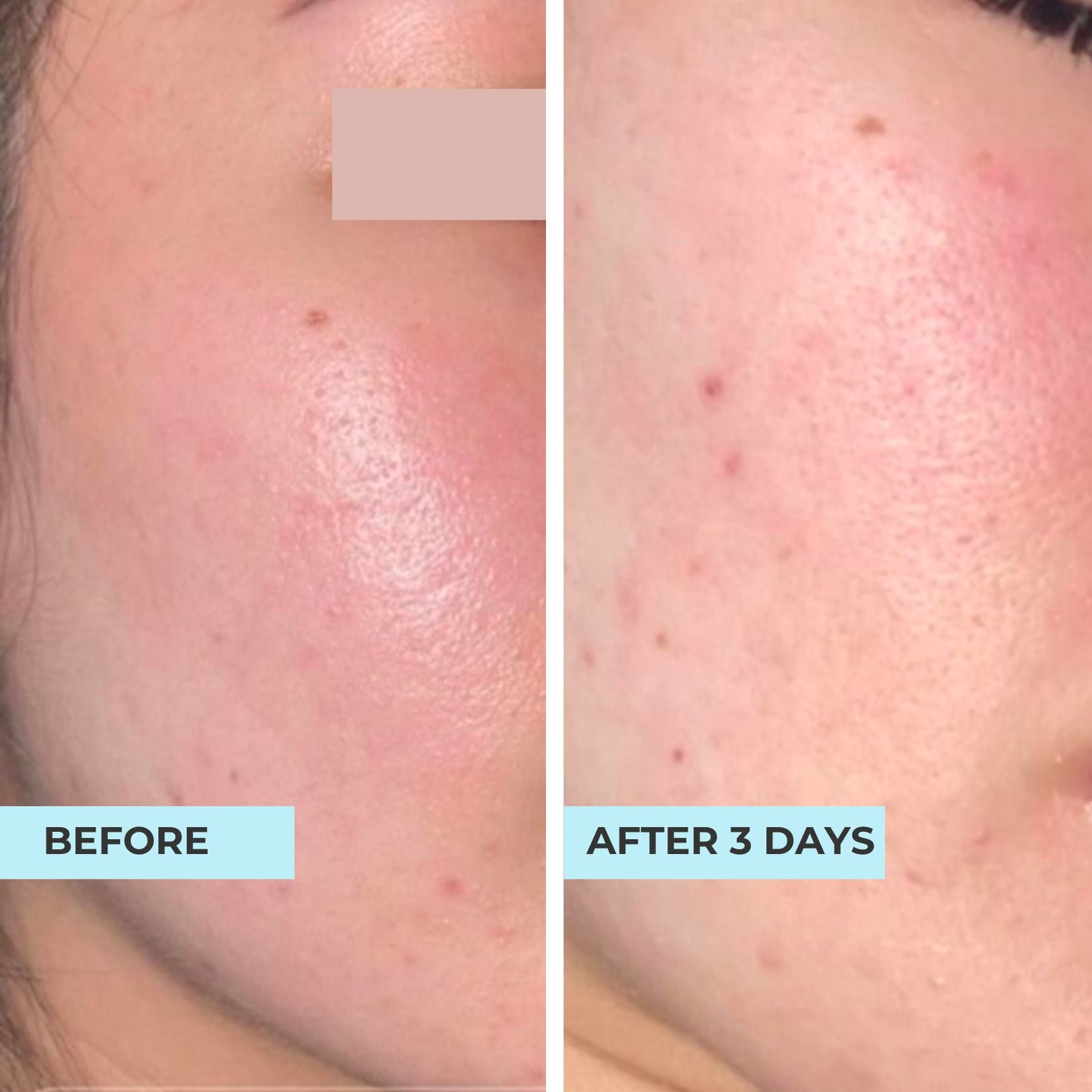 Secret Repair Hydrating Oligopeptide Serum
