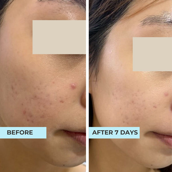 Customer result photo