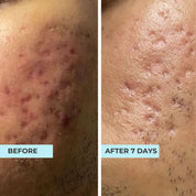 Sensitive Advanced Oligopeptide Serum