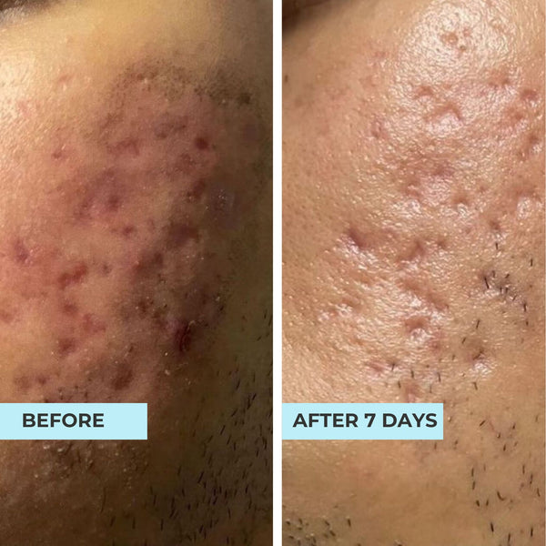 Customer result photo